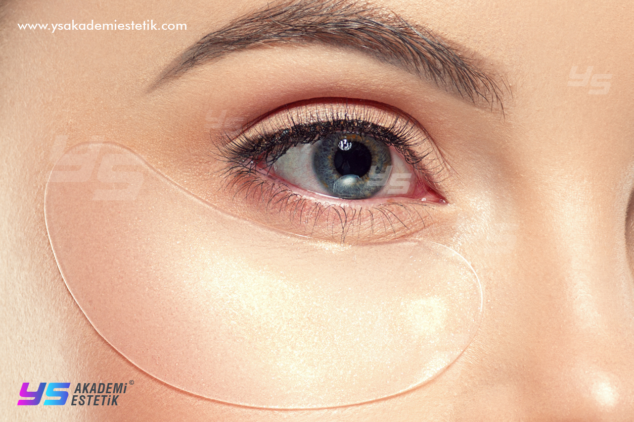 Göz altı morluk tedavisi Göz altı morlukları